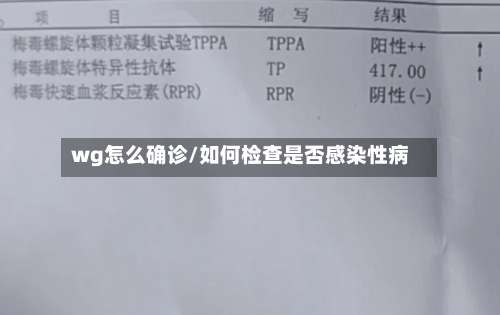 wg怎么确诊/如何检查是否感染性病-第2张图片