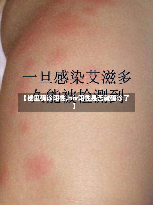 【楼里确诊阳性,hiv阳性是否就确诊了】-第3张图片