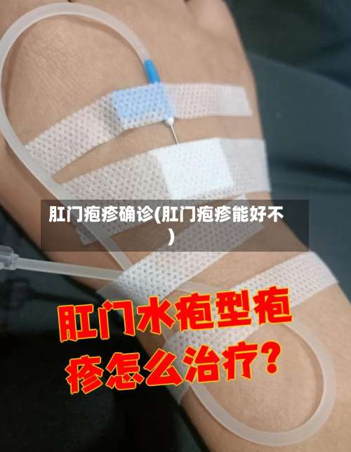 肛门疱疹确诊(肛门疱疹能好不)