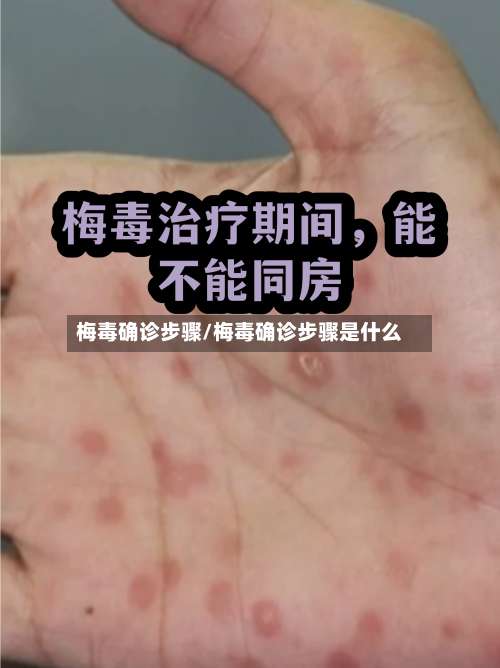 梅毒确诊步骤/梅毒确诊步骤是什么-第2张图片