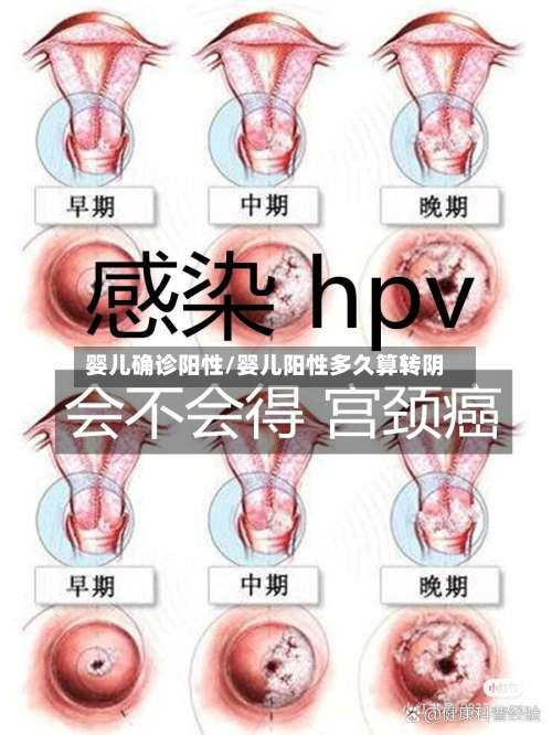 婴儿确诊阳性/婴儿阳性多久算转阴-第3张图片