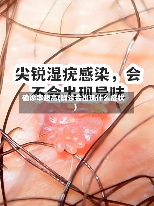 确诊率超高(确诊会出现什么症状)-第2张图片