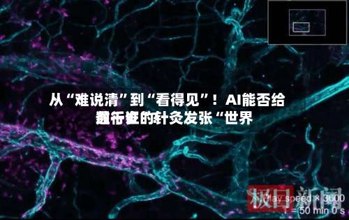 从“难说清	”到“看得见”！AI能否给数千岁的针灸发张“世界通行证”？-第2张图片