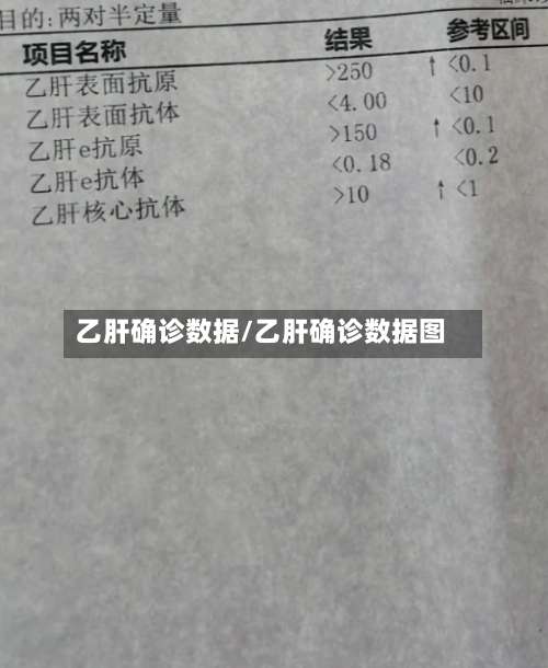 乙肝确诊数据/乙肝确诊数据图