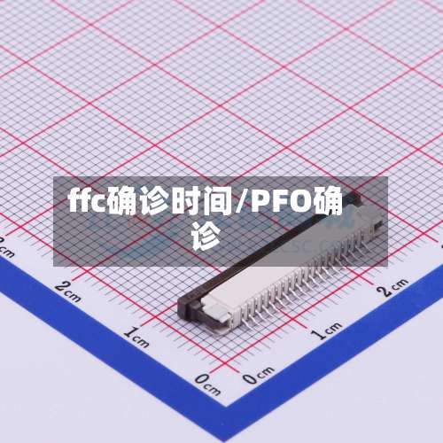 ffc确诊时间/PFO确诊-第2张图片