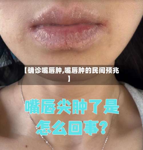 【确诊嘴唇肿,嘴唇肿的民间预兆】-第3张图片
